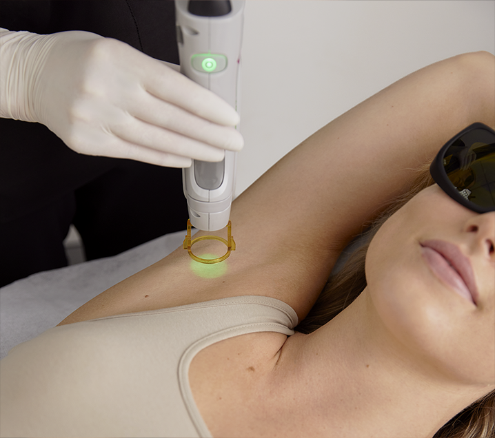Local laser sales hair removal