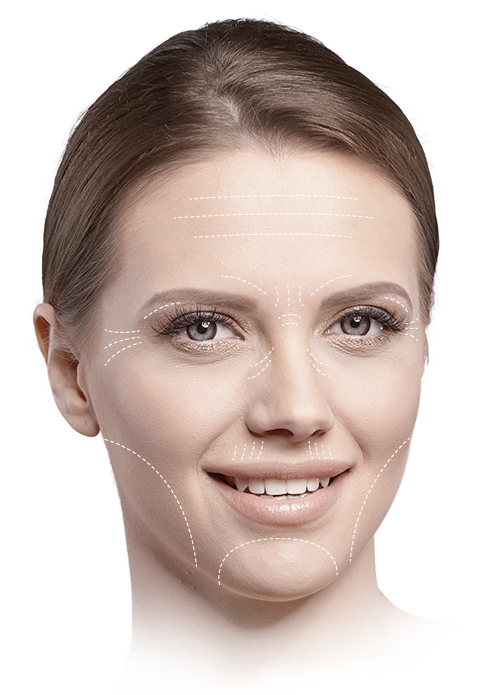 Wrinkle Treatment Areas