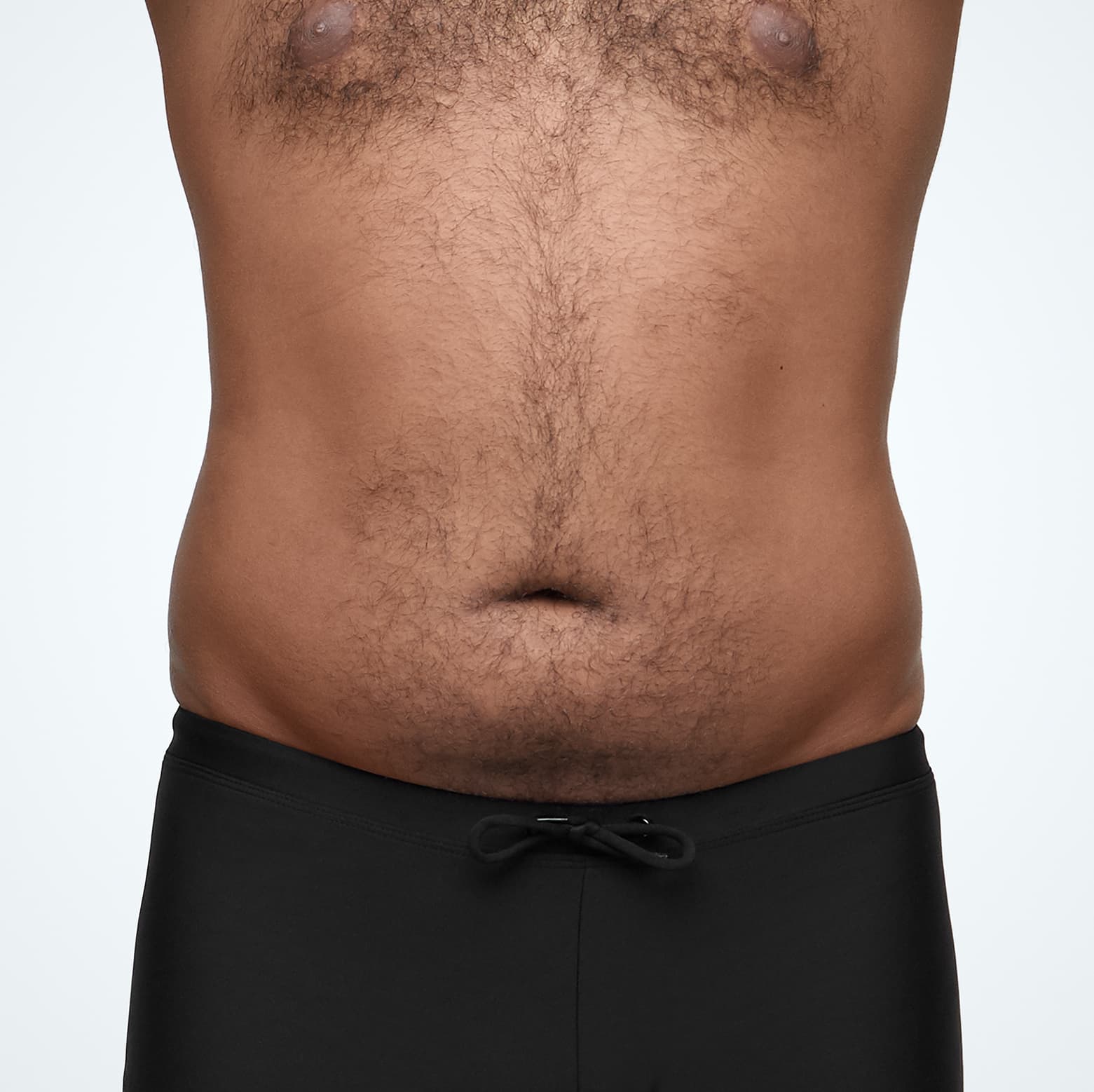 Abdomen_Male_Model1_Before_Front.jpg