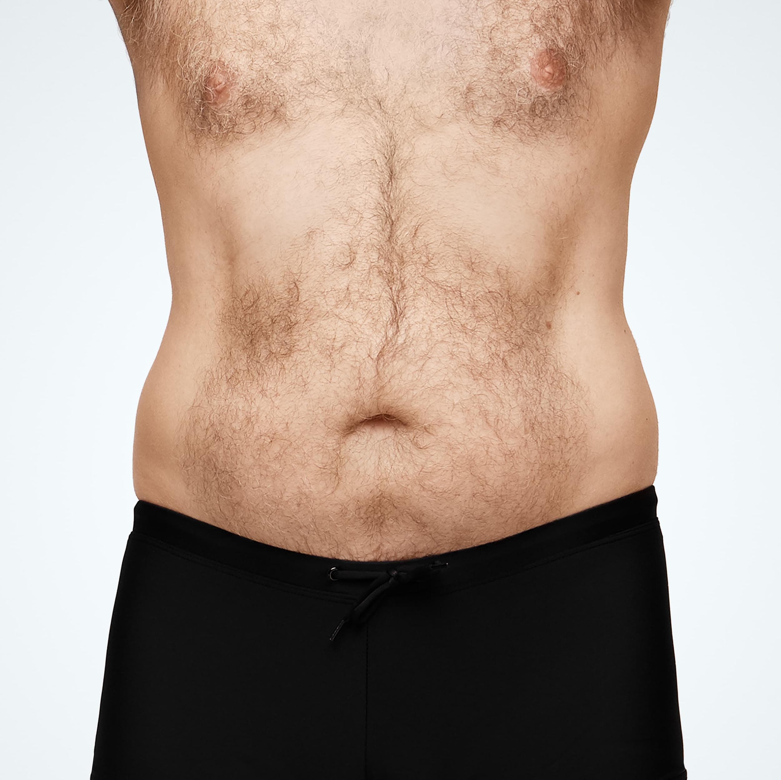 Abdomen_Male_Model2_Before_Front.jpg