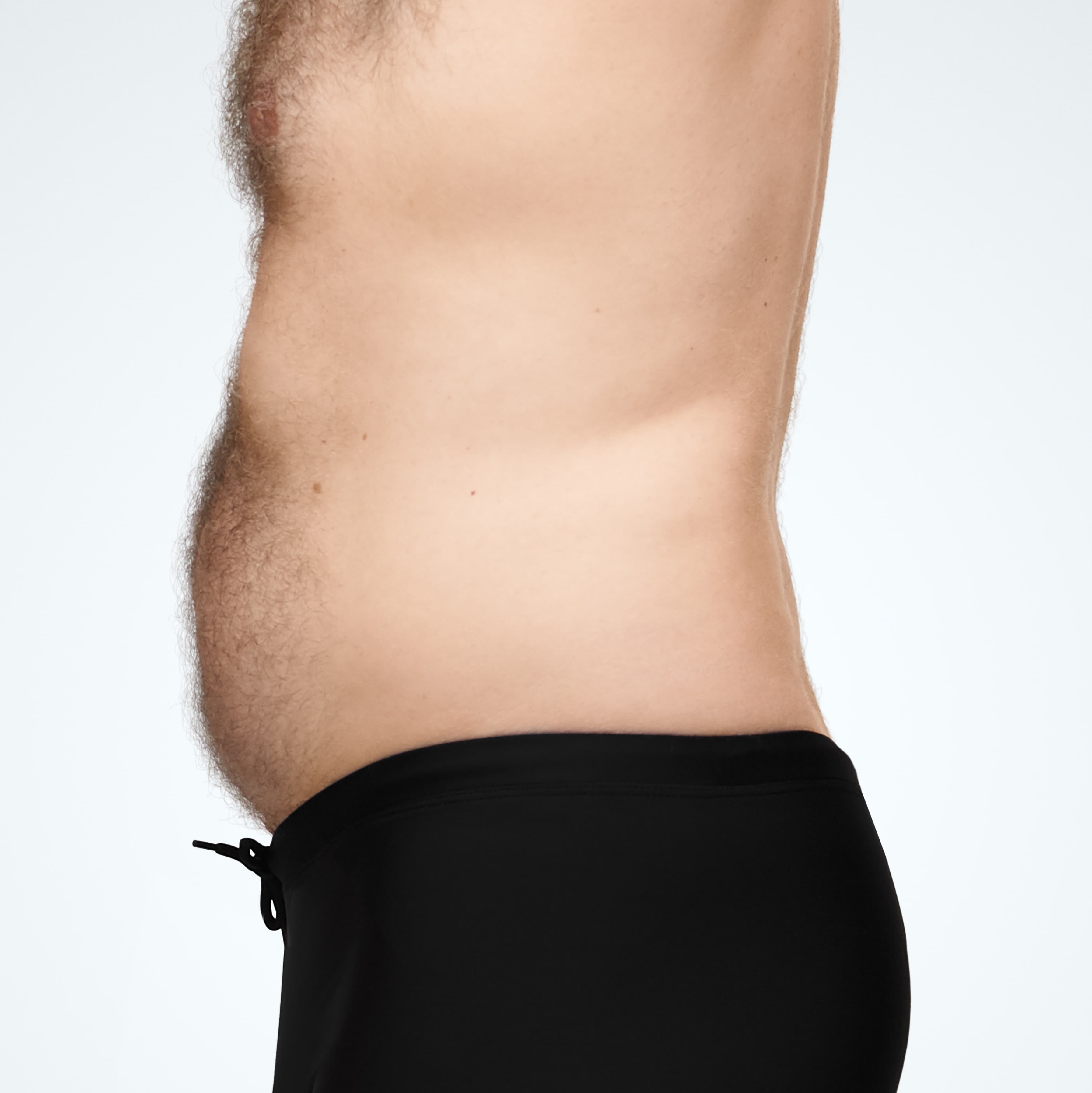 Abdomen_Male_Model2_Before_Left_Side_Profile.jpg